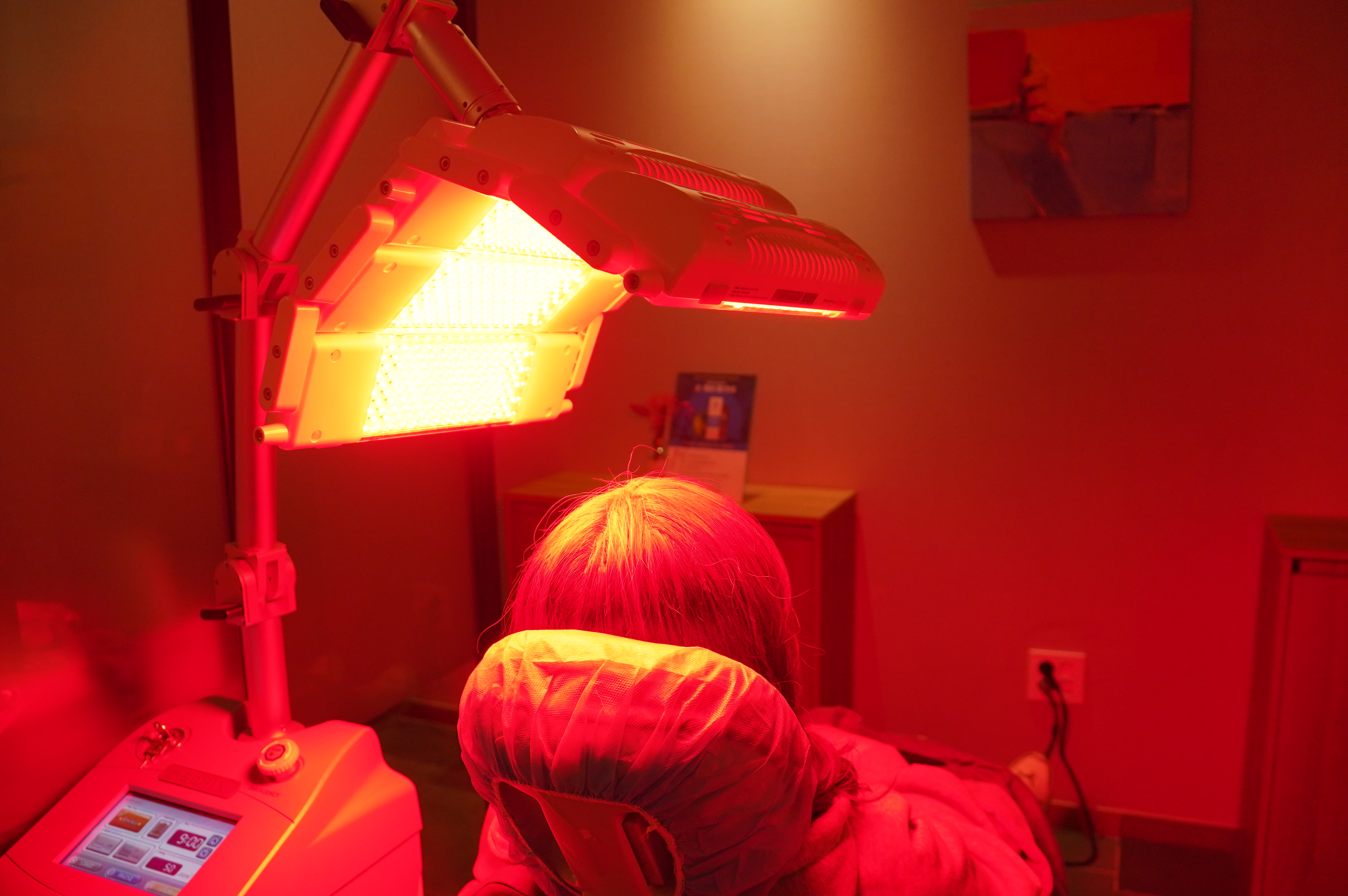 M자 헤어라인 회복 전략 2