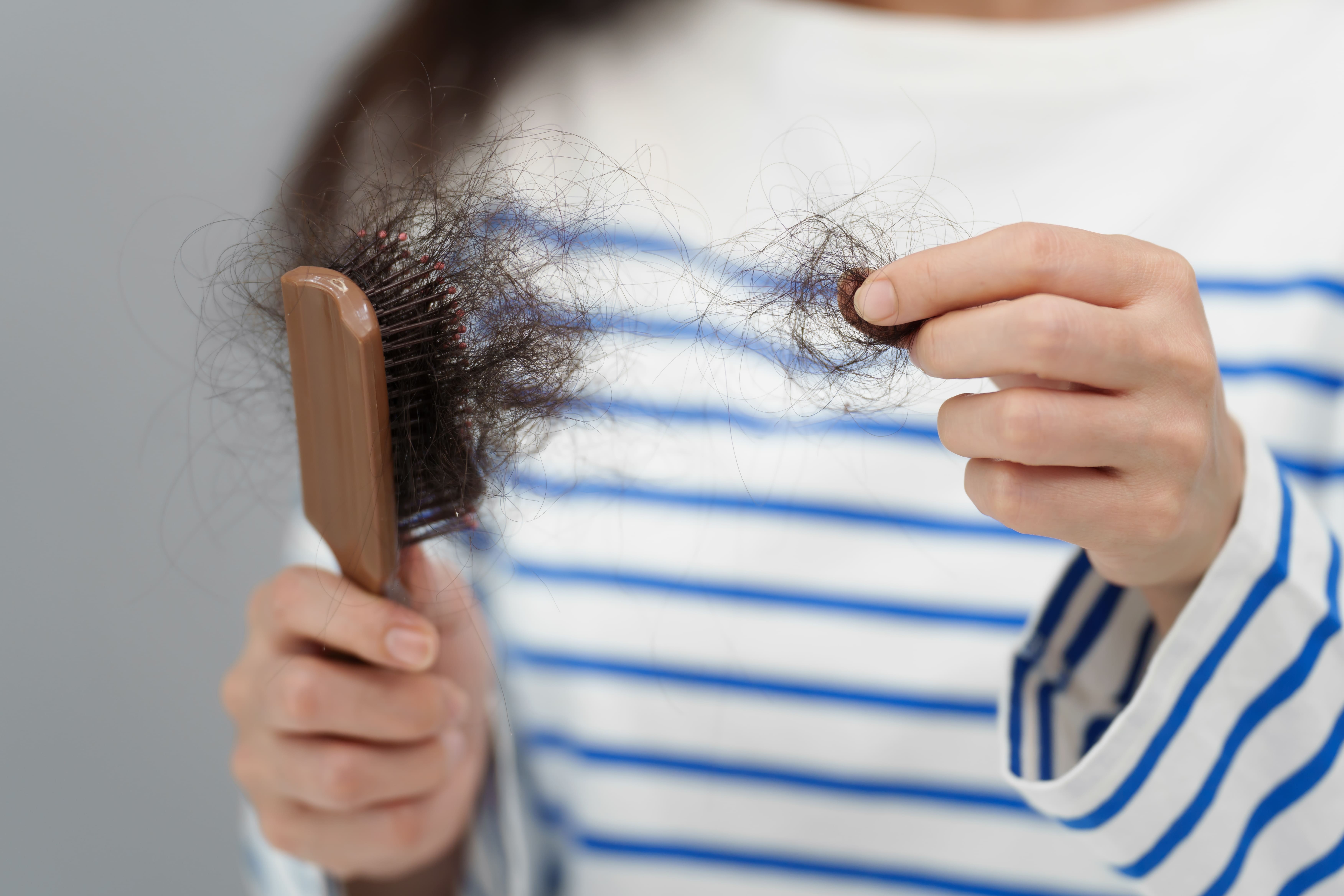 Postpartum Hair Regrowth Timeline