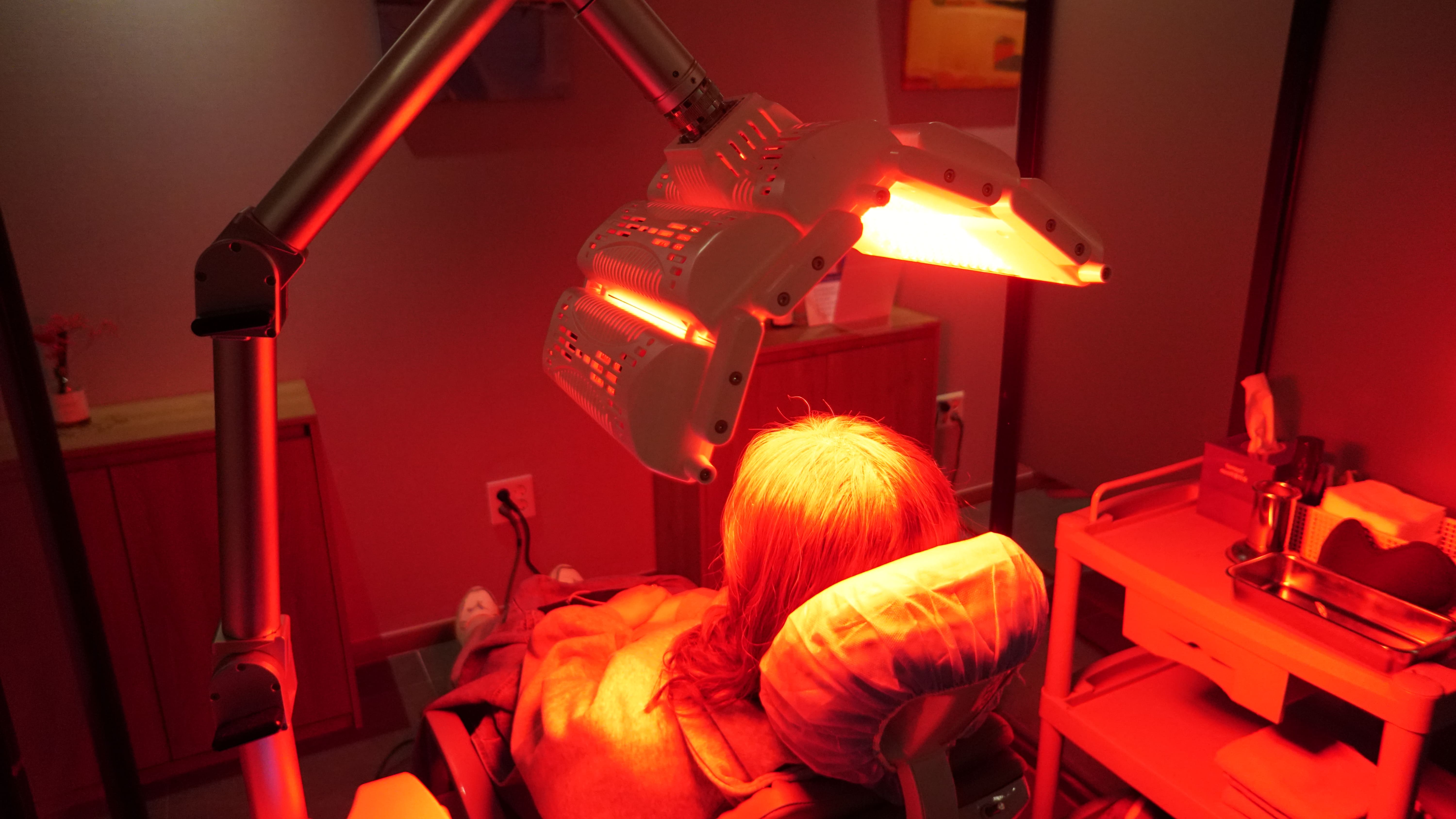 원형탈모 치료법