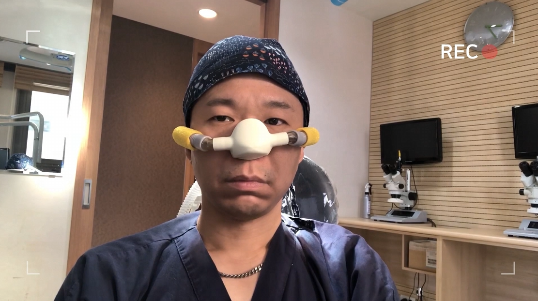 모발이식 질소가스 웃음가스 마취