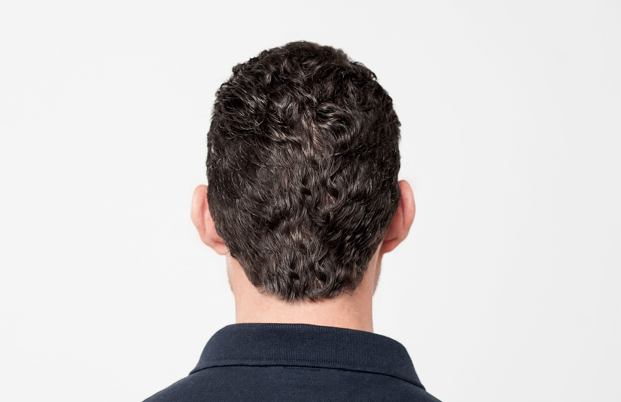 cosmetic scar camouflage techniques like hair fibers or root sprays