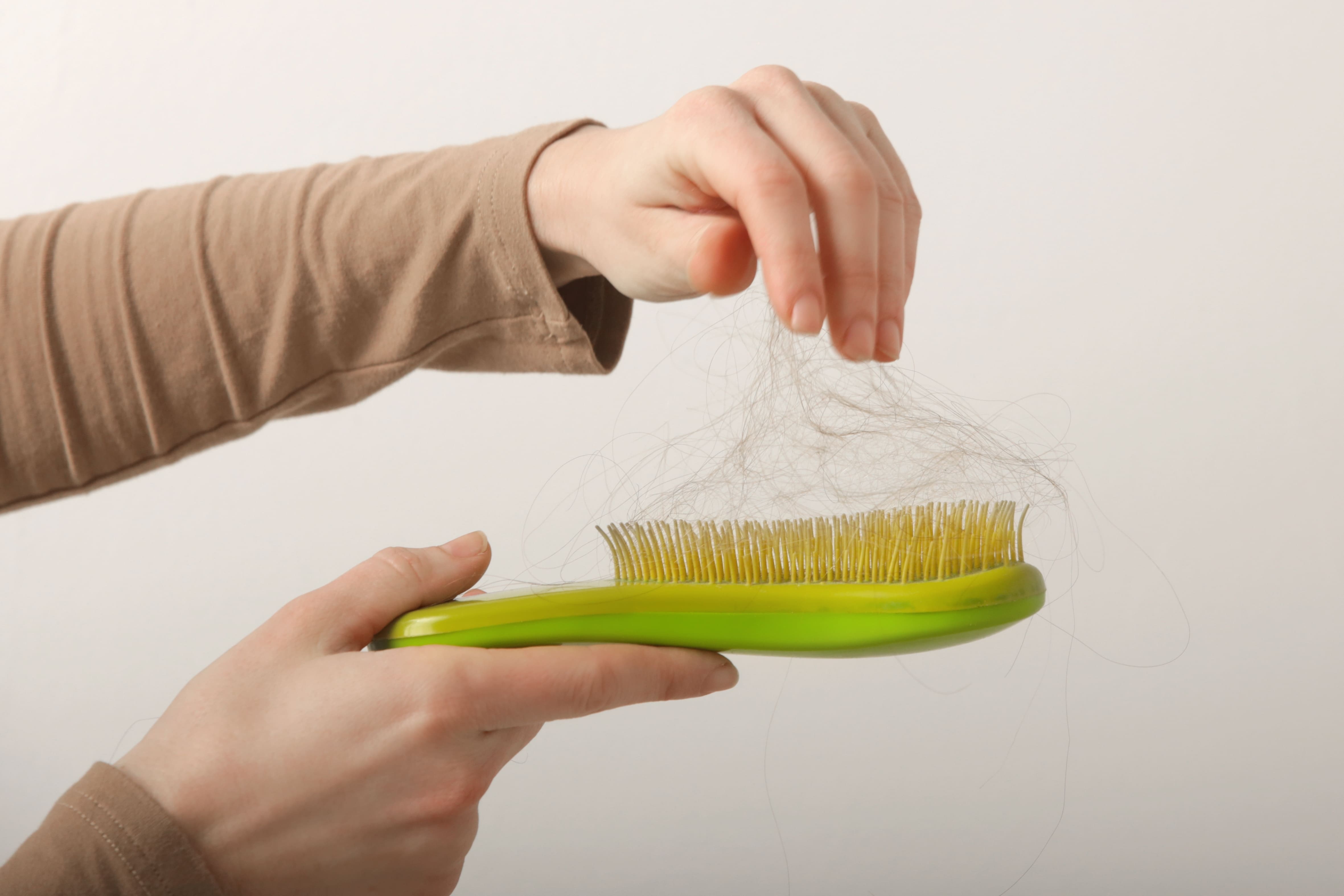 남성탈모 초기 증상