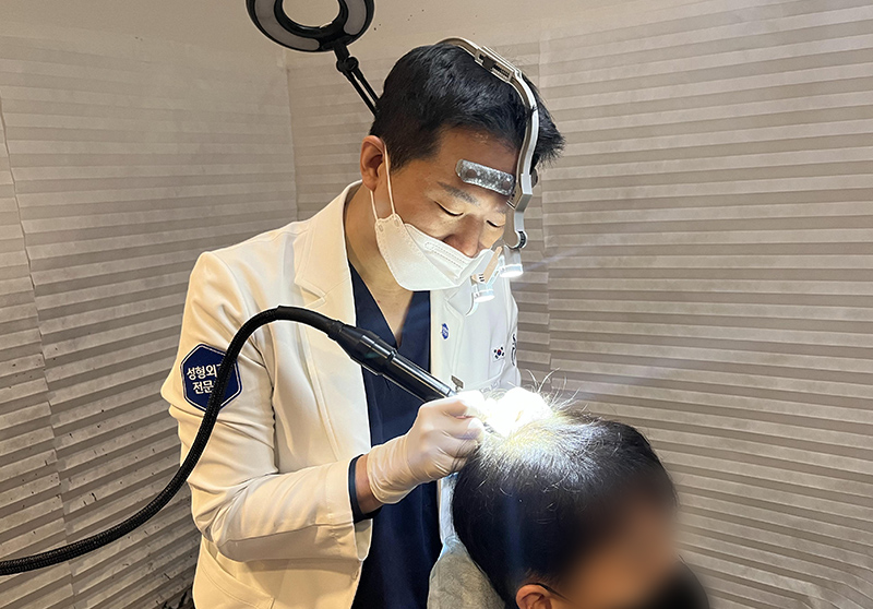 무바늘 두피문신 SMP