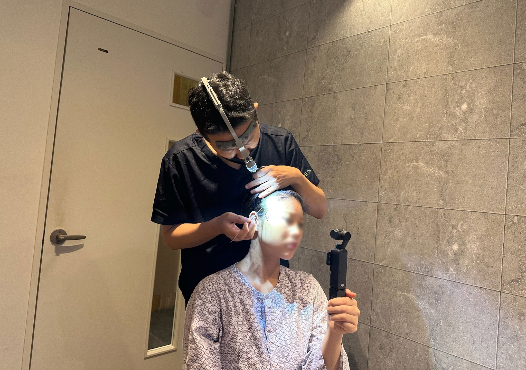 Methods of Reduce Swelling After a Hair Transplant